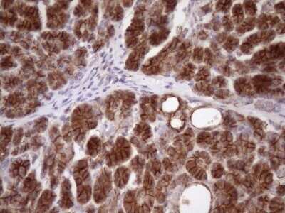 Immunohistochemistry: beta-Catenin Antibody (OTI2F10) - Azide and BSA Free [NBP2-70511] - Analysis of Human pancreas tissue. (Heat-induced epitope retrieval by Tris-EDTA, pH8.0)