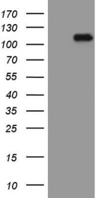Western Blot: beta-Catenin Antibody (OTI2F10) - Azide and BSA Free [NBP2-70511] - Analysis of HEK293T cells were transfected with the pCMV6-ENTRY control (Left lane) or pCMV6-ENTRY beta-Catenin.
