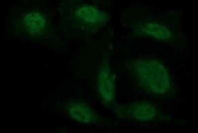 Immunocytochemistry/Immunofluorescence: beta-Catenin Antibody (OTI9C1) - Azide and BSA Free [NBP2-70508] - Analysis of HeLa cells.