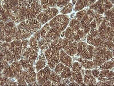 Immunohistochemistry: beta-Catenin Antibody (OTI9C1) - Azide and BSA Free [NBP2-70508] - Analysis of Human pancreas tissue. (Heat-induced epitope retrieval by 10mM citric buffer, pH6.0, 120C for 3min)