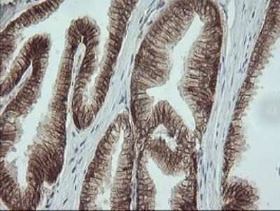 Immunohistochemistry: beta-Catenin Antibody (OTI9C1) - Azide and BSA Free [NBP2-70508] - Analysis of Human prostate tissue. (Heat-induced epitope retrieval by 10mM citric buffer, pH6.0, 120C for 3min)