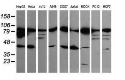 Western Blot: beta-Catenin Antibody (OTI9C1) - Azide and BSA Free [NBP2-70508] - Analysis of extracts (35ug) from 9 different cell lines (HepG2: human; HeLa: human; SVT2: mouse; A549: human; COS7: monkey; Jurkat: human; MDCK: canine; PC12: rat; MCF7: human).