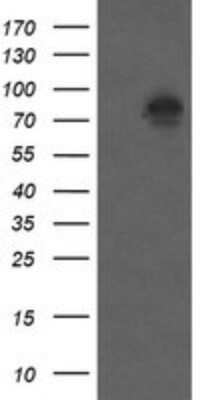 Western Blot: beta-Catenin Antibody (OTI9C1) - Azide and BSA Free [NBP2-70508] - Analysis of HEK293T cells were transfected with the pCMV6-ENTRY control (Left lane) or pCMV6-ENTRY beta-Catenin.