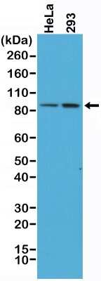 Western Blot: beta-Catenin Antibody (RM276) [NBP2-61498] - Western Blot of HeLa and 293 cells lysates using NBP2-61498.
