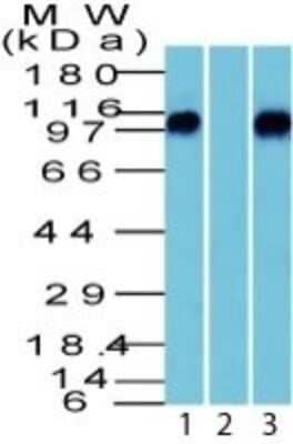 Western Blot: beta-Catenin Antibody [NBP2-29476] - Western Blot of beta-Catenin (p120) in human brain 1) absence and 2) presence of immunizing peptide and 3) Mouse brain lysate using beta-Catenin PAb.