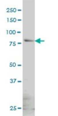 Western Blot: beta-Galactosidase-1/GLB1 Antibody (6E7) [H00002720-M01] - GLB1 monoclonal antibody (M01), clone 6E7 Analysis of GLB1 expression in HeLa.