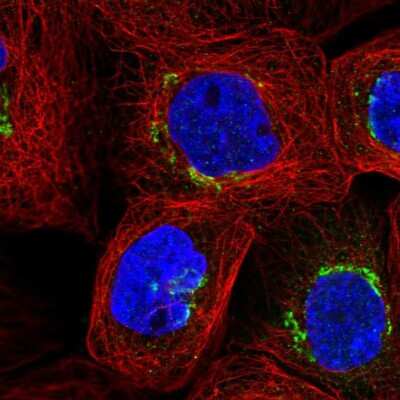 Immunocytochemistry/Immunofluorescence: beta-Galactosidase-1/GLB1 Antibody [NBP2-57793] - Staining of human cell line A-431 shows localization to the Golgi apparatus & vesicles.