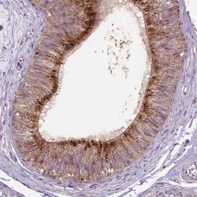 Immunohistochemistry-Paraffin: beta-Galactosidase-1/GLB1 Antibody [NBP2-49602] - Staining of human epididymis shows high expression.