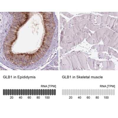 Immunohistochemistry-Paraffin: beta-Galactosidase-1/GLB1 Antibody [NBP2-49602] - Staining in human epididymis and skeletal muscle tissues using anti-GLB1 antibody. Corresponding GLB1 RNA-seq data are presented for the same tissues.