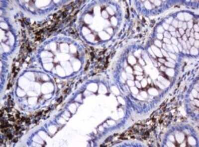 Immunohistochemistry: beta-Galactosidase-1/GLB1 Antibody (OTI1C9) - Azide and BSA Free [NBP2-70829] - Analysis of Human colon tissue. (Heat-induced epitope retrieval by 10mM citric buffer, pH6.0, 120C for 3min)