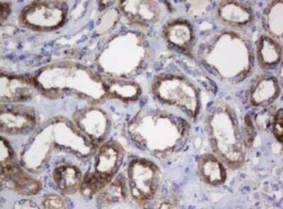 Immunohistochemistry: beta-Galactosidase-1/GLB1 Antibody (OTI1C9) - Azide and BSA Free [NBP2-70829] - Analysis of Human Kidney tissue. (Heat-induced epitope retrieval by 10mM citric buffer, pH6.0, 120C for 3min)