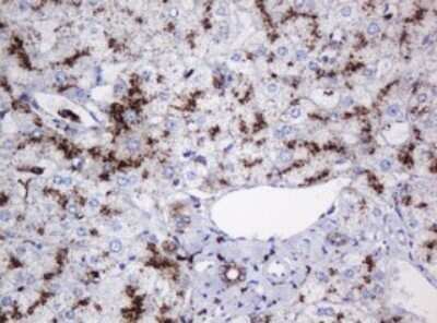 Immunohistochemistry: beta-Galactosidase-1/GLB1 Antibody (OTI1C9) - Azide and BSA Free [NBP2-70829] - Analysis of Human liver tissue. (Heat-induced epitope retrieval by 10mM citric buffer, pH6.0, 120C for 3min)