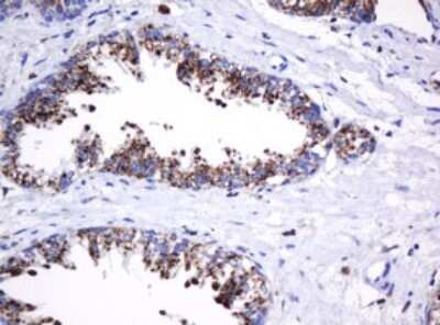 Immunohistochemistry: beta-Galactosidase-1/GLB1 Antibody (OTI1C9) - Azide and BSA Free [NBP2-70829] - Analysis of Human prostate tissue. (Heat-induced epitope retrieval by 10mM citric buffer, pH6.0, 120C for 3min)