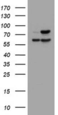 Western Blot: beta-Galactosidase-1/GLB1 Antibody (OTI1C9) - Azide and BSA Free [NBP2-70829] - Analysis of HEK293T cells were transfected with the pCMV6-ENTRY control (Left lane) or pCMV6-ENTRY GLB1 .