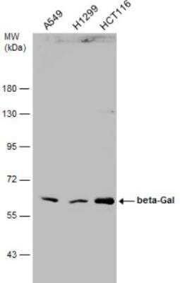 Western Blot: beta-Galactosidase-1/GLB1 Antibody [NBP1-32018] - Various whole cell extracts (30 ug) were separated by 7.5% SDS-PAGE, and the membrane was blotted with beta-Gal antibody [N2C3] diluted at 1:1000. 