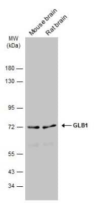 Western Blot: beta-Galactosidase-1/GLB1 Antibody [NBP3-13394] - Various tissue extracts (50 ug) were separated by 7.5% SDS-PAGE, and the membrane was blotted with beta-Galactosidase-1/GLB1 antibody (NBP3-13394) diluted at 1:1000. The HRP-conjugated anti-rabbit IgG antibody (NBP2-19301) was used to detect the primary antibody.