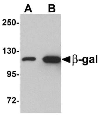 Western Blot: beta Galactosidase Antibody [NBP1-76322] - Analysis of (A) 5 and (B) 25 ng of b-gal with b-gal antibody at 1 ug/mL.