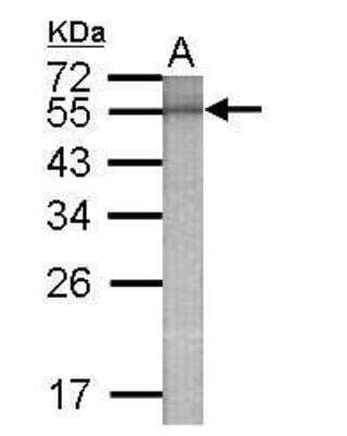 Western Blot: beta Galactosidase Antibody [NBP2-42819] - Experiment using Beta-gal Antibody at 1:90000 dilution to detect 100ng of 55kDa recombinant Beta-gal protein antigen.