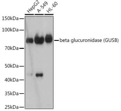 Western Blot: beta-Glucuronidase/GUSB Antibody (4U0E2) [NBP3-15711] - Western blot analysis of extracts of various cell lines, using beta glucuronidase (beta-Glucuronidase/GUSB) antibody (NBP3-15711) at 1:1000 dilution. Secondary antibody: HRP Goat Anti-Rabbit IgG (H+L) at 1:10000 dilution. Lysates/proteins: 25ug per lane. Blocking buffer: 3% nonfat dry milk in TBST. Detection: ECL Basic Kit. Exposure time: 180s.