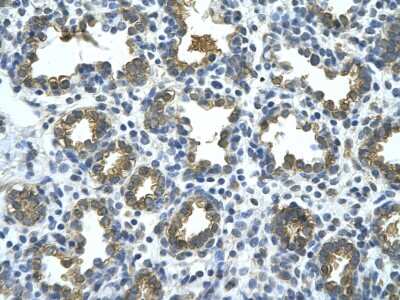 Immunohistochemistry: beta-Glucuronidase/GUSB Antibody [NBP1-69355] - Human alveolar cell Cellular data: Epithelial cells of renal tubule Antibody Concentration: 4.0-8.0 ug/ml Magnification: 400X.