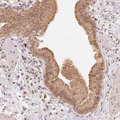 Immunohistochemistry-Paraffin: beta-Glucuronidase/GUSB Antibody [NBP2-38293] - Staining of human gallbladder shows moderate cytoplasmic positivity in glandular cells.