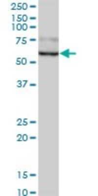 Western Blot: beta-Glucuronidase/GUSB Antibody [H00002990-B01P] - Analysis of GUSB expression in human liver.