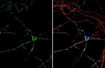 Immunocytochemistry/Immunofluorescence: beta-Hydroxy-GABA Antibody [NBP3-13407] - beta-Hydroxy-GABA antibody detects beta-Hydroxy-GABA protein by immunofluorescent analysis. Sample: DIV9 rat E18 primary hippocampal neuron cells were fixed in 4% paraformaldehyde at RT for 15 min. Green: beta-Hydroxy-GABA stained by beta-Hydroxy-GABA antibody (NBP3-13407) diluted at 1:500. Red: Tau, stained by Tau antibody [GT287] diluted at 1:500. Blue: Fluoroshield with DAPI.