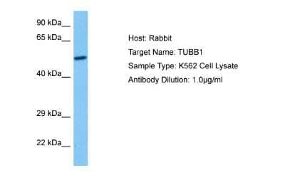 Western Blot: beta I + II Tubulin Antibody [NBP2-83948] - Host: Rabbit. Target Name: TUBB1. Sample Tissue: Human K562 Whole Cell lysates. Antibody Dilution: 1ug/ml