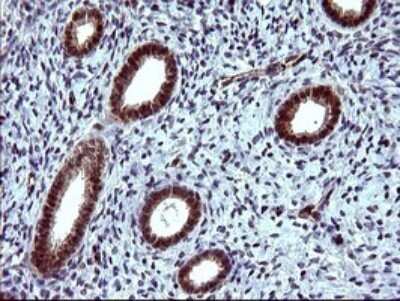 Immunohistochemistry: beta I Tubulin Antibody (OTI4A3) - Azide and BSA Free [NBP2-72225] - Analysis of Human endometrium tissue. (Heat-induced epitope retrieval by 10mM citric buffer, pH6.0, 120C for 3min)