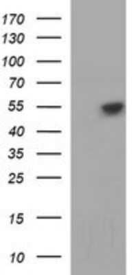 Western Blot: beta I Tubulin Antibody (OTI4A3) - Azide and BSA Free [NBP2-72225] - Analysis of HEK293T cells were transfected with the pCMV6-ENTRY control (Left lane) or pCMV6-ENTRY beta 1 Tubulin.