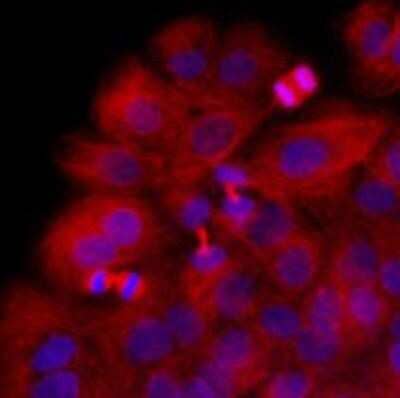 Immunocytochemistry/Immunofluorescence: beta II Tubulin B Antibody (5B2) [NBP1-74037] - Immunofluorescence of HaCaT cells stained with Hoechst 3342 (Blue) for nucleus staining and monoclonal anti-human beta-Tubulin antibody (1:1000) with Texas Red (Red).