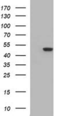 Western Blot: beta II Tubulin B Antibody (OTI6D11) - Azide and BSA Free [NBP2-72505] - Analysis of HEK293T cells were transfected with the pCMV6-ENTRY control (Left lane) or pCMV6-ENTRY beta 2 Tubulin B.