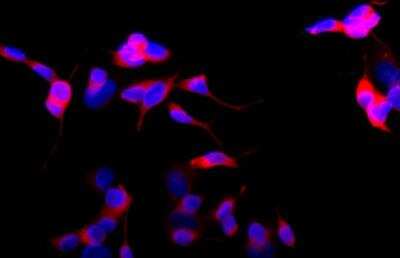 Immunocytochemistry/Immunofluorescence: beta-III Tubulin Antibody (SDL.3D10) [NB120-11314] - SH-SY-5Y cells were fixed and permeabilized with methanol followed by methanol:acetone. Fixed cells were stained with 1:400 Monoclonal Anti-beta-Tubulin III Clone: SDL.3D10  The antibody was developed using Goat Anti-Mouse IgG, Cy3(r) conjugate. Cells were counterstained with DAPI (blue) to stain nuclei.