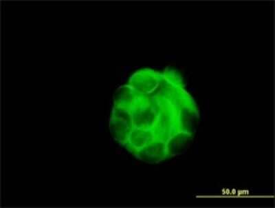 Immunocytochemistry/Immunofluorescence: beta Sarcoglycan Antibody (1C10) [H00006443-M02] - Analysis of monoclonal antibody to SGCB on MCF-7 cell . Antibody concentration 10 ug/ml.