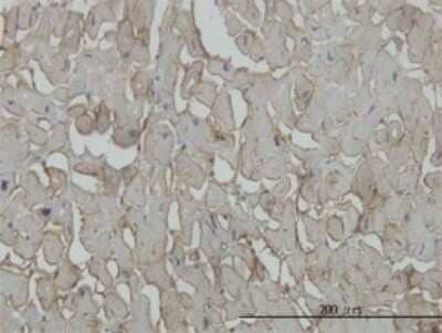 Immunohistochemistry-Paraffin: beta Sarcoglycan Antibody (1C10) [H00006443-M02] - Analysis of monoclonal antibody to SGCB on formalin-fixed paraffin-embedded human heart. Antibody concentration 3 ug/ml.