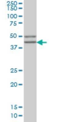 Western Blot: beta Sarcoglycan Antibody (1C10) [H00006443-M02] - SGCB monoclonal antibody (M02), clone 1C10 Analysis of SGCB expression in MCF-7.