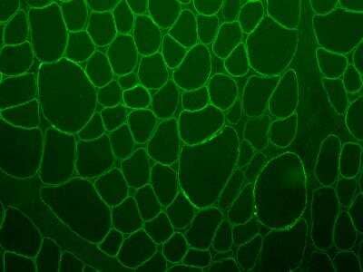 Immunohistochemistry-Frozen: beta Sarcoglycan Antibody [NBP2-54977] - Human skeletal muscle tissue. IHC-Fr image submitted by a verified customer review.