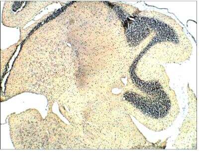 Immunohistochemistry-Paraffin: beta Sarcoglycan Antibody [NBP3-12235] - Rat cerebellum-Soluble guanylate beta 1. 1:100 dilution in IHC blocking buffer. DAB (brown) staining and Hematoxylin QS (blue) counterstain. 5X magnification on leica DM4000 microscope. FFPE section.