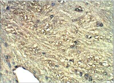 Immunohistochemistry-Paraffin: beta Sarcoglycan Antibody [NBP3-12235] - Soluble guanylate cyclase beta 1. 1:100 dilution in IHC blocking buffer. DAB (brown) staining and Hematoxylin QS (blue) counterstain. 40X magnification on Leica  DM4000 microscope. FFPE sections. 