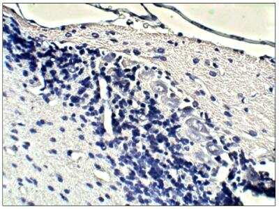 Immunohistochemistry-Paraffin: beta Sarcoglycan Antibody [NBP3-12235] - Soluble guanylate cyclase beta 1. 1:100 dilution in IHC blocking buffer. DAB (brown) staining and Hematoxylin QS (blue) counterstain. 40X magnification on Leica  DM4000 microscope. FFPE sections. 