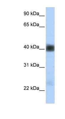 Western Blot: beta Sarcoglycan Antibody [NBP1-59751] - Titration: 0.2-1 ug/ml, Positive Control: Human heart.