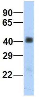 Western Blot: beta Sarcoglycan Antibody [NBP1-59751] - Tissue: Human Fetal Heart