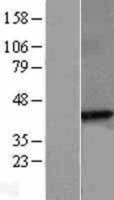 Western Blot: beta Sarcoglycan Overexpression Lysate (Adult Normal) [NBL1-15903] Left-Empty vector transfected control cell lysate (HEK293 cell lysate); Right -Over-expression Lysate for beta Sarcoglycan.