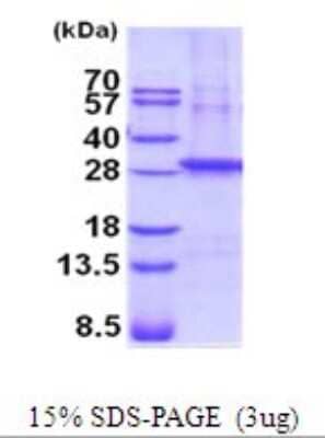 SDS-Page: Recombinant Human beta Sarcoglycan Protein [NBP2-52098] - 15% SDS Page (3 ug)