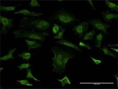 Immunocytochemistry/Immunofluorescence: beta-Synuclein Antibody (3G6) [H00006620-M02] - Analysis of monoclonal antibody to SNCB on HeLa cell . Antibody concentration 10 ug/ml.