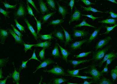 Immunocytochemistry/Immunofluorescence: beta-Synuclein Antibody [NBP2-97152] - Staining of SNCB in HeLa cells. Cells were fixed with 4% PFA, permeabilzed with 0.1% Triton X-100 in PBS,blocked with 10% serum, and incubated with rabbit anti-Human SNCB polyclonal antibody (dilution ratio 1:200) at 4? overnight. Then cells were stained with the Alexa Fluor®488-conjugated Goat Anti-rabbit IgG secondary antibody (green) and counterstained with DAPI (blue).Positive staining was localized to Cytoplasm.