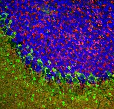 Immunocytochemistry/Immunofluorescence: beta-Synuclein Antibody [NBP3-05556] - Immunofluorescent analysis of rat cerebellum section stained with beta-Synuclein Antibody at a dilution of 1:1,000 in red, and costained with chicken pAb to parvalbumin at a dilution of 1:5,000 in green. The blue is Hoechst staining of nuclear DNA. Following transcardial perfusion of rat with 4% paraformaldehyde, brain was post fixed for 24 hours, cut to 45uM, and free-floating sections were stained with above antibodies. The beta-Synuclein antibody detects protein concentrated in synaptic regions, and parvalbumin antibody labels the perikarya and dendrites of Purkinje cells, and interneurons in the molecular layer of the cerebellum.