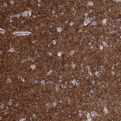 Immunohistochemistry-Paraffin: beta-Synuclein Antibody [NBP1-90342] - Staining of human cerebral cortex shows high expression.