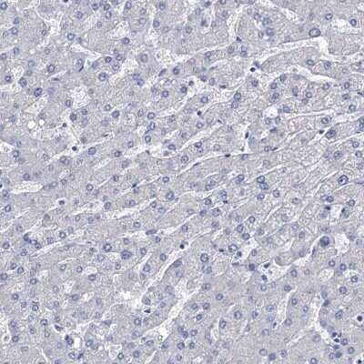 Immunohistochemistry-Paraffin: beta-Synuclein Antibody [NBP1-90342] - Staining of human liver shows low expression as expected.