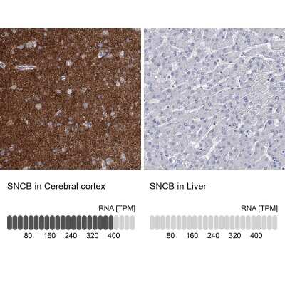 <b>Orthogonal Strategies Validation. </b>Immunohistochemistry-Paraffin: beta-Synuclein Antibody [NBP1-90342] - Staining in human cerebral cortex and liver tissues using anti-SNCB antibody. Corresponding SNCB RNA-seq data are presented for the same tissues.